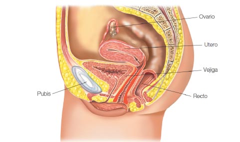 La importancia del suelo pélvico en la Esclerosis Múltiple