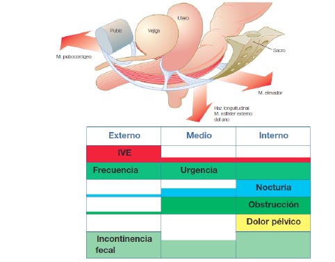 Suelo Pélvico y Prolapso de Órganos Pélvicos - IDYTUR Urología